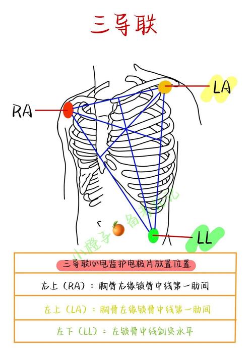 心电图导联位置图解——十字定位法，教你十秒牢记心电图操作